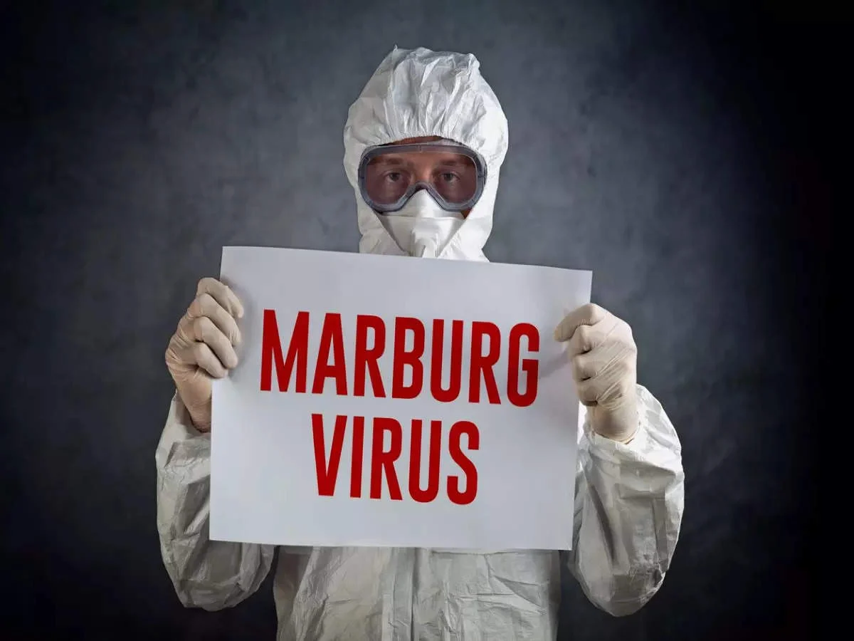 VIRUS ya Marburg Imaze Guhitana abantu 8 mu RWANDA Mu Minsi 3