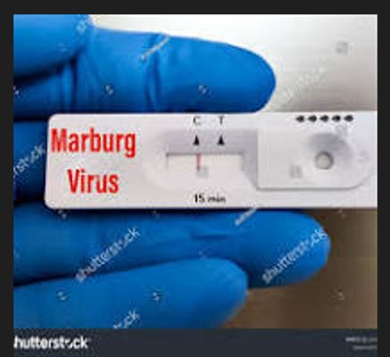 Taliki 29 Ukwakira: Amakuru mashya kuri virus ya Marburg mu Rwanda